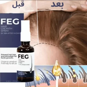 البخاخ السحري لعلاج تساقط الشعر FEG